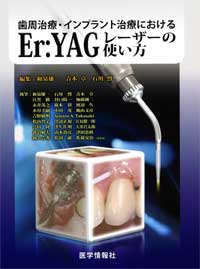 歯周治療・インプラント治療におけるEr:YAGレーザーの使い方