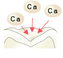 歯の再石灰化3