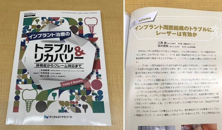 インプラント治療のトラブル＆リカバリー