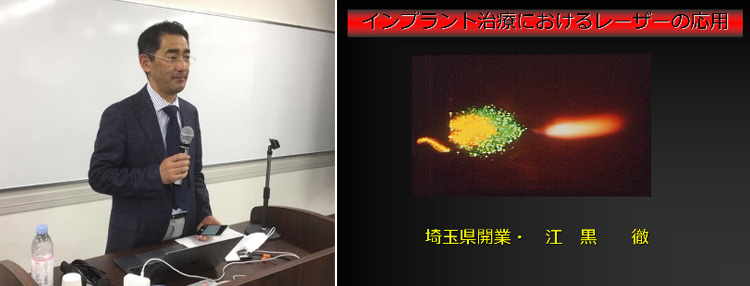 インプラント講義