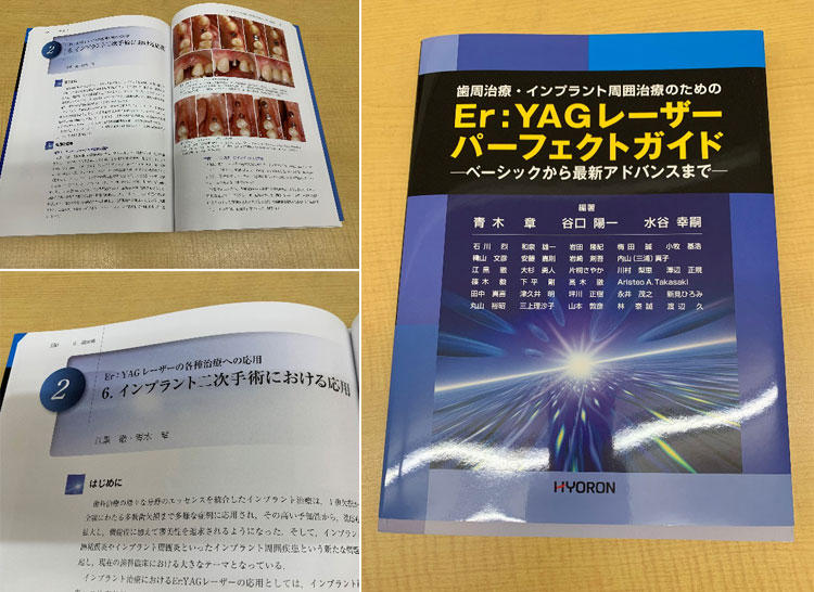 Er:YAGレーザー　パーフェクトガイド